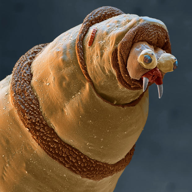 Electron Microscope Images - Every Day Objects - Blue Bottle Fly Larva